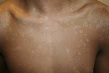 Why Is My Tan Fading So Quick? (And How to Make It Last Longer) - Jessica Lee Cosmetics